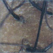 Scalp Analysis